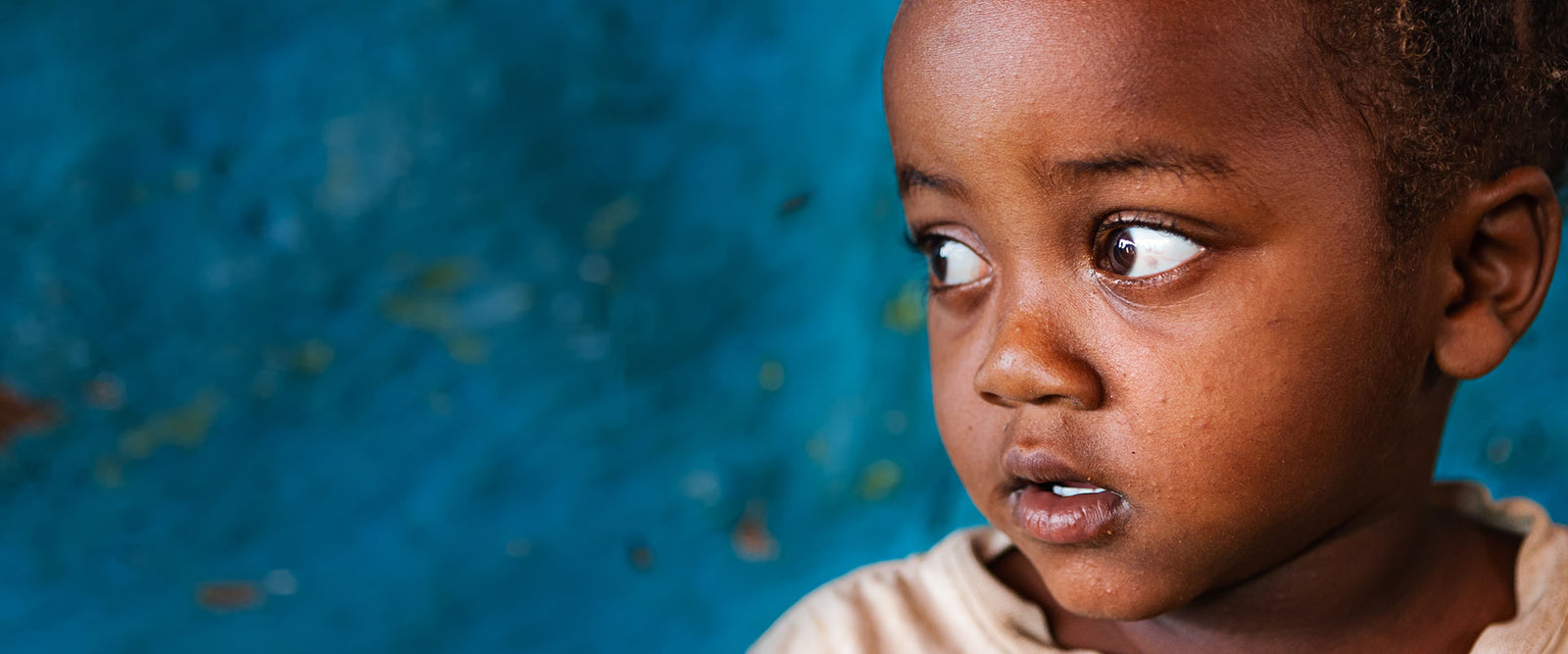 Vitamin angels, a boy with sad looking forward.
